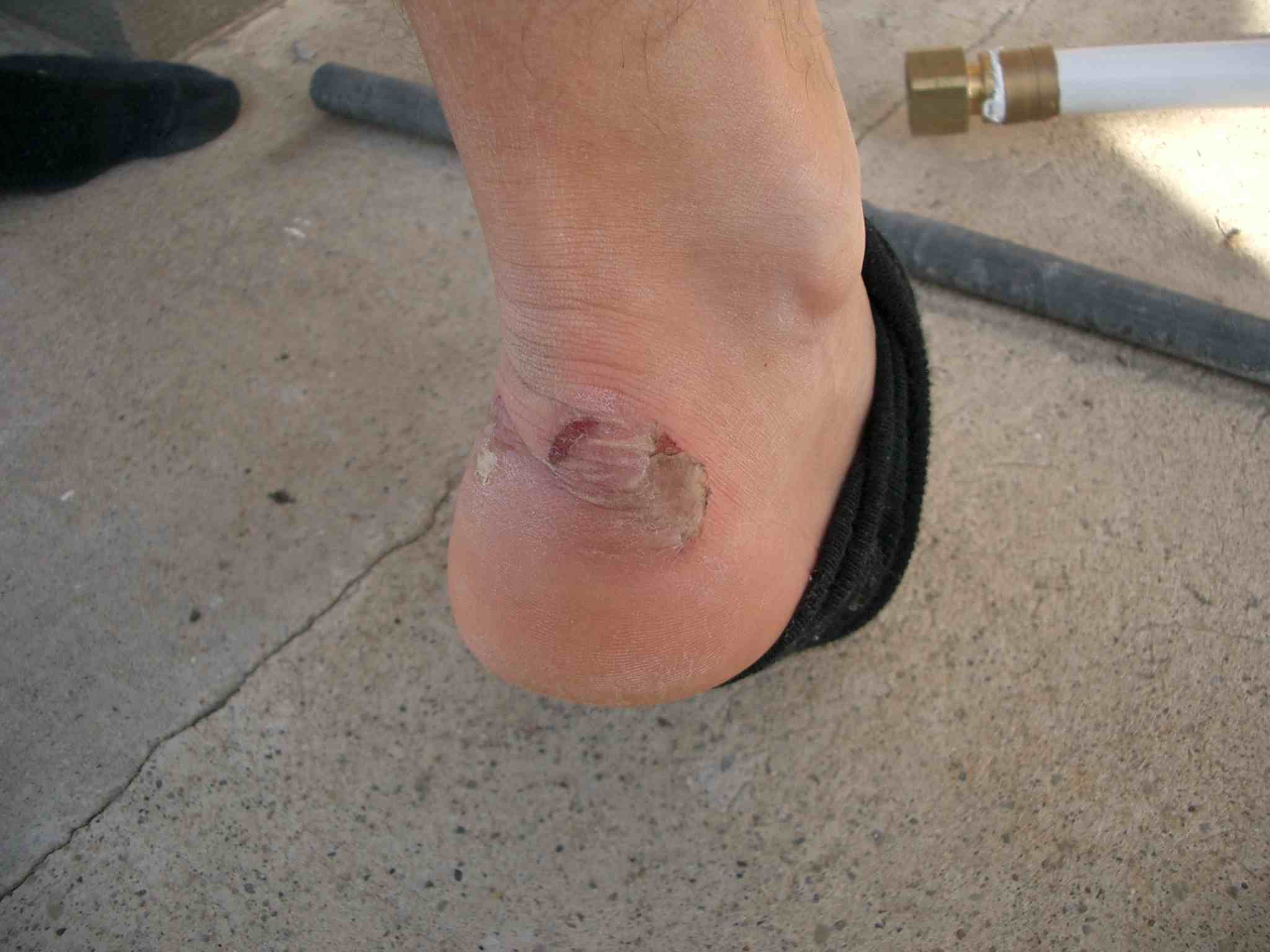 Schwere Verletzungen