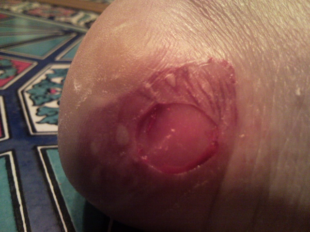 Nix für schwache Nerven