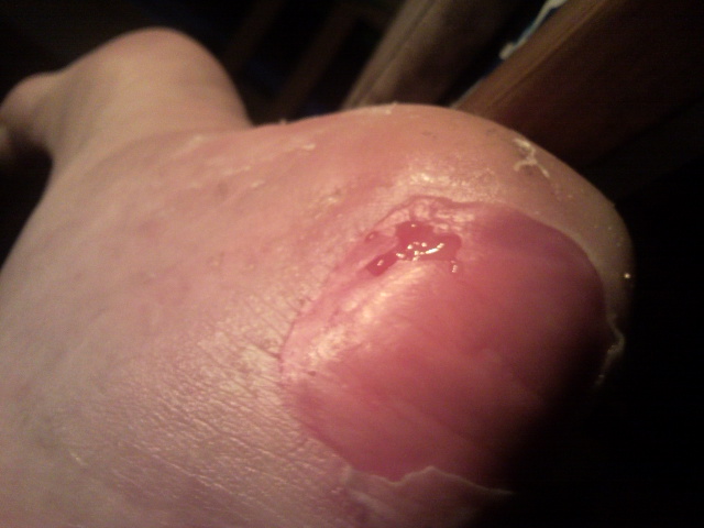 Nix für schwache Nerven